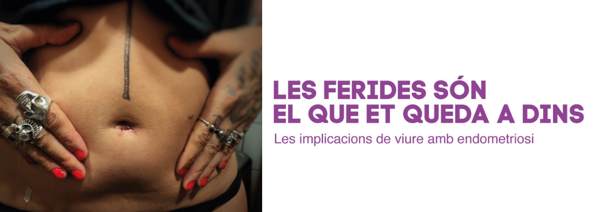 Les ferides són el que et queda a dins. Les implicacions de viure amb endometriosi